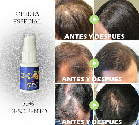 LÍQUIDO CRECE CABELLO PARA HOMBRE Y MUJER